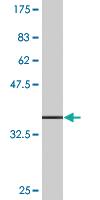 Anti-ETNK1 Mouse Monoclonal Antibody [clone: 1F3]