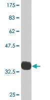 Anti-PDLIM1 Mouse Monoclonal Antibody [clone: 2D4]