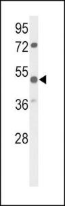 Anti-PARVA Rabbit Polyclonal Antibody (HRP (Horseradish Peroxidase))