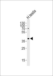 Anti-TSPY2 Rabbit Polyclonal Antibody