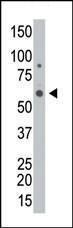 Anti-GALK2 Rabbit Polyclonal Antibody (HRP (Horseradish Peroxidase))