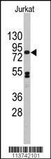 Anti-CDH12 Rabbit Polyclonal Antibody (AP (Alkaline Phosphatase))