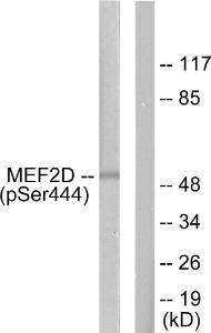 Western blot analysis of lysates from HepG2 cells treated with forskolin 40nM 30' using Anti-MEF2D (phospho Ser444) Antibody The right hand lane represents a negative control, where the antibody is blocked by the immunising peptide