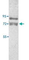 Anti-PAK1 Rabbit Polyclonal Antibody