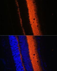 Immunofluorescence analysis of mouse eye using Anti-Synaptotag min Antibody (A12750) at a dilution of 1:100 (40X lens). DAPI was used to stain the cell nuclei (blue)