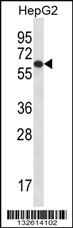 Anti-TBC1D22A Rabbit Polyclonal Antibody