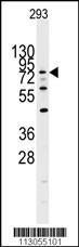 Anti-DYRK1A Rabbit Polyclonal Antibody (FITC (Fluorescein))