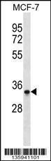 Anti-MAD2L1BP Rabbit Polyclonal Antibody (HRP (Horseradish Peroxidase))