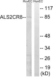 Western blot analysis of lysates from HUVEC cells using Anti-ALS2CR8 Antibody. The right hand lane represents a negative control, where the antibody is blocked by the immunising peptide