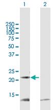 Anti-PRDX5 Mouse Polyclonal Antibody