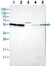 Anti-SLC15A4 Rabbit Polyclonal Antibody