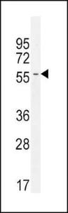 Anti-INHBA Rabbit Polyclonal Antibody (APC (Allophycocyanin))