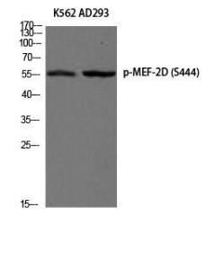 Western blot analysis of K562 AD293 using Anti-MEF2D (phospho Ser444) Antibody