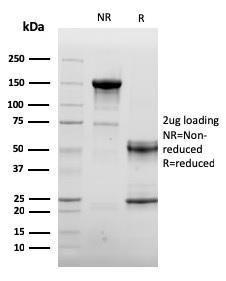 SDS-PAGE analysis of Anti-CD105 Antibody [ENG/3269] under non-reduced and reduced conditions; showing intact IgG and intact heavy and light chains, respectively. SDS-PAGE analysis confirms the integrity and purity of the antibody