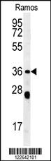 Anti-TLE4 Rabbit Polyclonal Antibody