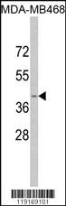 Anti-APOL1 Rabbit Polyclonal Antibody