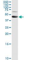 Anti-CDGIi, CMS14, CMSTA3, NET38, hALPG2 Rabbit Polyclonal Antibody