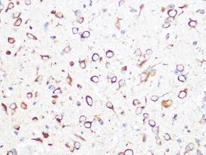 Immunohistochemistry analysis of paraffin-embedded rat brain using Anti-CCT2 Antibody [ARC1097] (A307296) at a dilution of 1:100 (40X lens). Perform microwave antigen retrieval with 10 mM PBS buffer pH 7.2 before commencing with IHC staining protocol