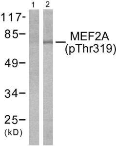 Anti-MEF2A+MEF2C Rabbit Polyclonal Antibody