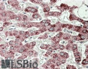 EB08546 (3.8 µg/ml) staining of paraffin embedded Human Liver-. Steamed antigen retrieval with citrate buffer pH 6, AP-staining.