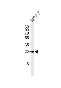 Anti-CDKN1B Rabbit Polyclonal Antibody