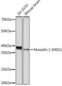 Western blot analysis of extracts of various cell lines, using Anti-Musashi 1/Msi1 Antibody [ARC1796] (A307297) at 1:1000 dilution. The secondary Antibody was Goat Anti-Rabbit IgG H&L Antibody (HRP) at 1:10000 dilution. Lysates/proteins were present at 25 µg per lane