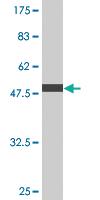 Anti-SSX2 Mouse Monoclonal Antibody [clone: 1A4]