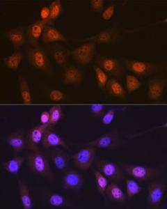 Immunofluorescence analysis of NIH-3T3 cells using Anti-Musashi 1/Msi1 Antibody [ARC1796] (A307297) at a dilution of 1:100 (40X lens). DAPI was used to stain the cell nuclei (blue)