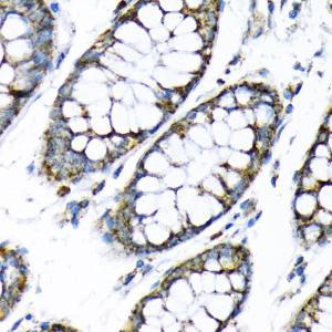 Immunohistochemistry analysis of paraffin-embedded human colon tissue using Anti-Hexokinase II Antibody (A12752) at a dilution of 1:200 (40x lens). Perform microwave antigen retrieval with 10 mM PBS buffer pH 7.2 before commencing with IHC staining protocol.