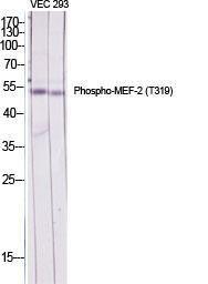 Anti-MEF2A+MEF2C Rabbit Polyclonal Antibody