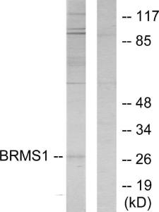 Anti-BRMS1 antibody