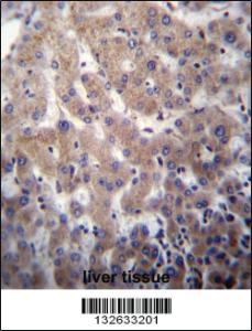 Anti-VSTM2A Rabbit Polyclonal Antibody