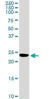 Anti-PRDX5 Rabbit Polyclonal Antibody