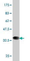 Anti-PBX1 Mouse Monoclonal Antibody [clone: 3F7]