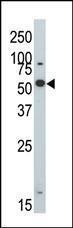 Anti-DYRK2 Rabbit Polyclonal Antibody (APC (Allophycocyanin))