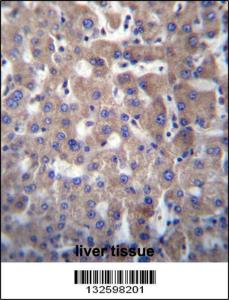 Anti-GGT2 Rabbit Polyclonal Antibody (AP (Alkaline Phosphatase))