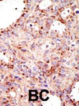 Anti-ARFGAP1 Rabbit Polyclonal Antibody (PE (Phycoerythrin))