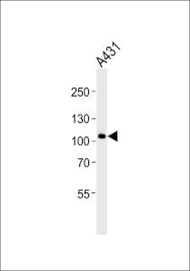 Anti-CTNND1 Rabbit Polyclonal Antibody