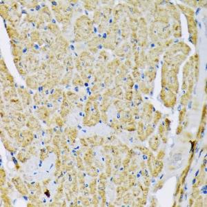 Immunohistochemistry analysis of paraffin-embedded mouse heart using Anti-Hexokinase II Antibody (A12752) at a dilution of 1:200 (40x lens). Perform microwave antigen retrieval with 10 mM PBS buffer pH 7.2 before commencing with IHC staining protocol.