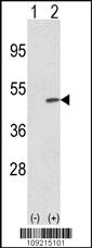 Anti-TRIB2 Rabbit Polyclonal Antibody