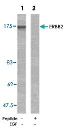 Anti-ERBB2 Rabbit Polyclonal Antibody