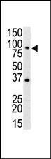 Anti-TLR4 Rabbit Polyclonal Antibody (AP (Alkaline Phosphatase))