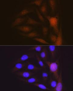 Immunofluorescence analysis of U-2 OS cells using Anti-Musashi 1/Msi1 Antibody [ARC1796] (A307297) at a dilution of 1:100 (40X lens). DAPI was used to stain the cell nuclei (blue)