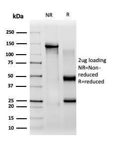 SDS-PAGE analysis of Anti-CBFB Antibody [PCRP-CBFB-1E6] under non-reduced and reduced conditions; showing intact IgG and intact heavy and light chains, respectively. SDS-PAGE analysis confirms the integrity and purity of the antibody