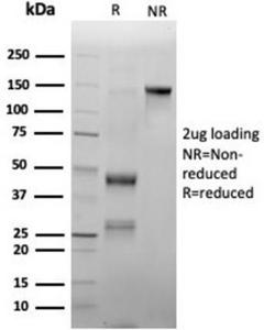 SDS-PAGE analysis of Anti-Myeloperoxidase Antibody [rMPO/6904] under non-reduced and reduced conditions; showing intact IgG and intact heavy and light chains, respectively. SDS-PAGE analysis confirms the integrity and purity of the antibody.