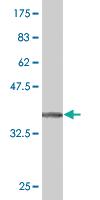 Anti-EPHA5 Mouse Monoclonal Antibody [clone: 5C3]