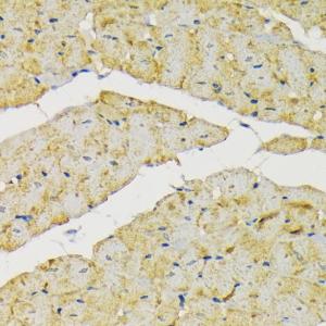 Immunohistochemistry analysis of paraffin-embedded rat heart using Anti-Hexokinase II Antibody (A12752) at a dilution of 1:200 (40x lens). Perform microwave antigen retrieval with 10 mM PBS buffer pH 7.2 before commencing with IHC staining protocol.