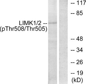 Western blot analysis of lysates from COLO205 cells using Anti-LIMK2 (phospho Thr505) Antibody. The right hand lane represents a negative control, where the antibody is blocked by the immunising peptide