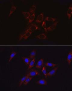 Immunofluorescence analysis of NIH/3T3 cells using Anti-Hexokinase II Antibody (A12752) at a dilution of 1:100 (40x lens). DAPI was used to stain the cell nuclei (blue).