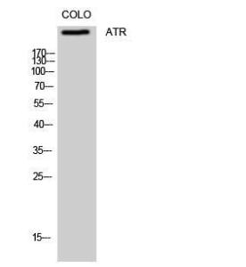 Western blot analysis of COLO cells using Anti-ATR Antibody